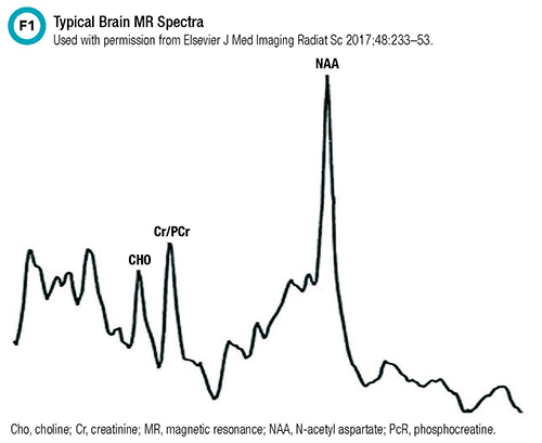 NMR typical brain MR spectra