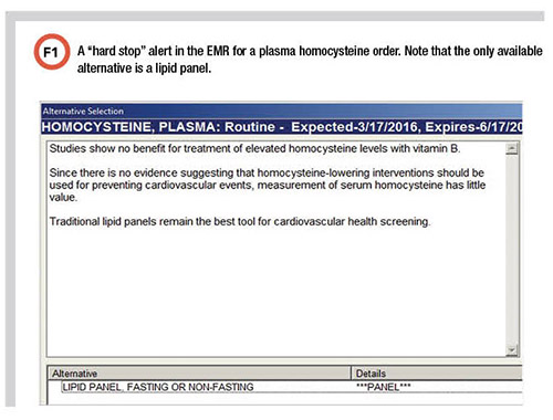 A "hard stop" alert in the EMR for a plasma homocysteine order. 