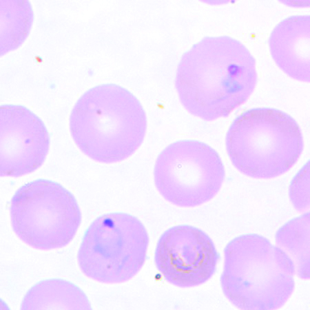 P. vivax in a thin blood smear.