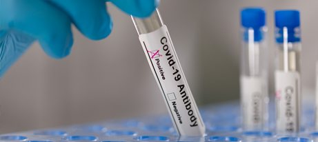 A gloved hand holds a test tube labeled COVID Antibody and with the box named positive checked