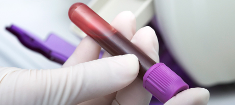 A gloved hand holding a purple topped test tube filled with blood