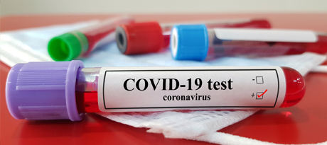  A horizontal blood filled test tube labeled covid-19 test rests in front of three other test tubes