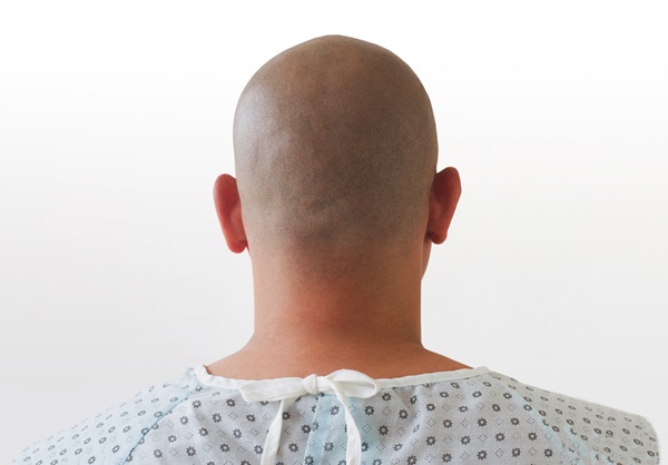 Bald patient