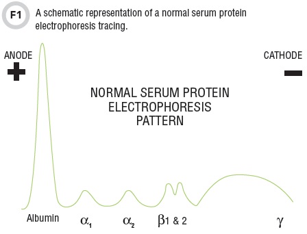 serum protein electrophoresis